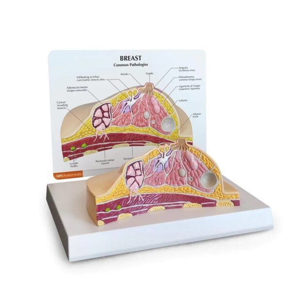 Breast Cross Section Model with Pathologies