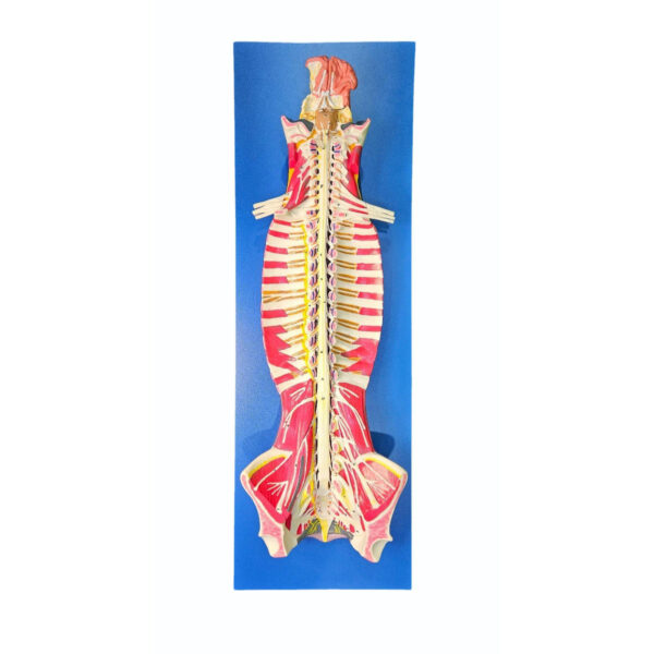 Spinal Cord in the Spinal Canal Model