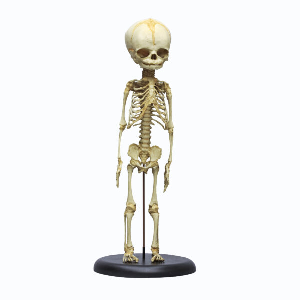 Foetus skeleton