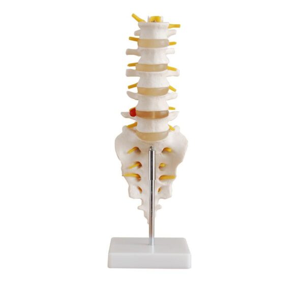 Life-Size Lumbar Vertebrae with Sacrum & Coccyx and Herniated Disc