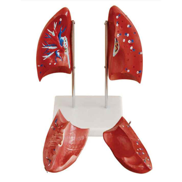 Lung Model