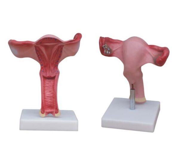 Magnified Uterus Model